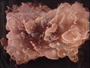 En bild i kraftig förstoring genom ett mikroskop som troligtvis föreställer en HIV-molekyl (CD4).